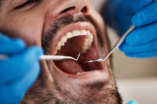 Best Weekend Emergency Dentist in St Leo, FL